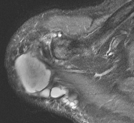 Figure 2 for case Geyser phenomenon